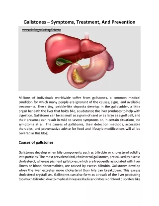 Gallstones – Symptoms, Treatment, And Prevention