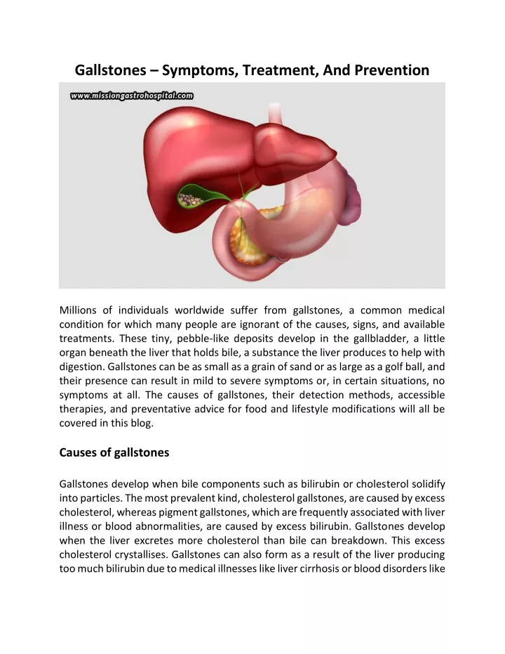 gallstones symptoms treatment and prevention