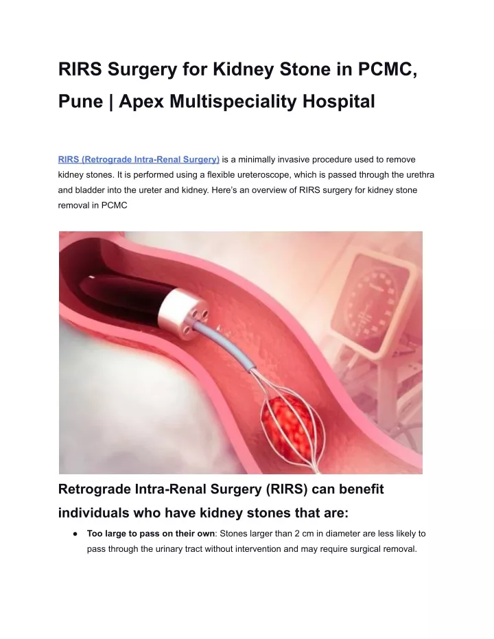 rirs surgery for kidney stone in pcmc