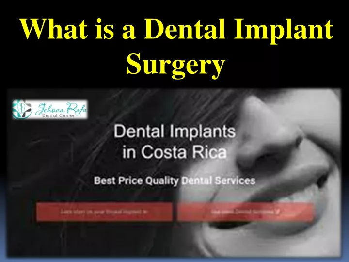 what is a dental implant surgery