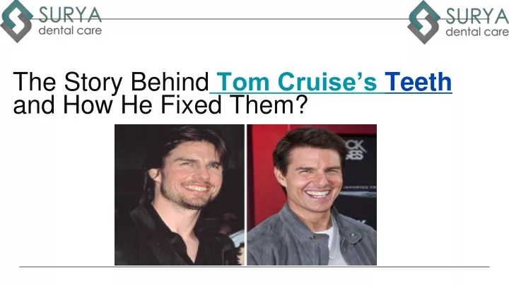 the story behind tom cruise s teeth and how he fixed them