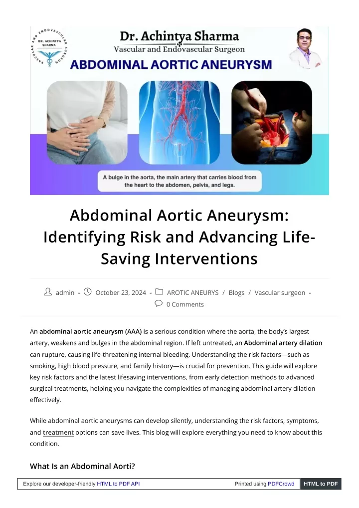 abdominal aortic aneurysm identifying risk