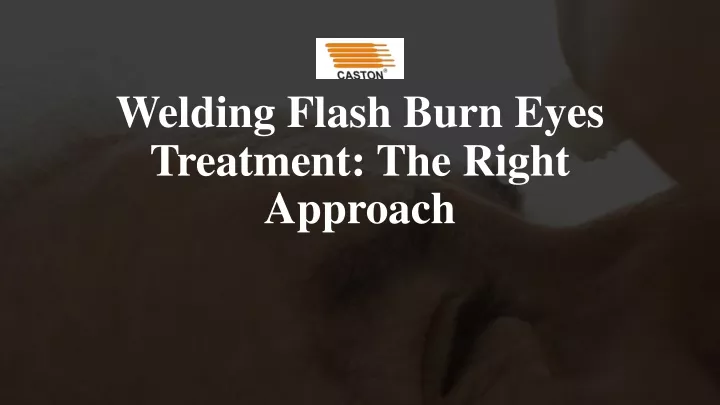 welding flash burn eyes treatment the right approach