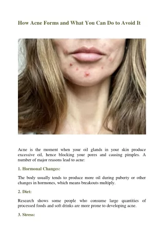 How Acne Forms and What You Can Do to Avoid It
