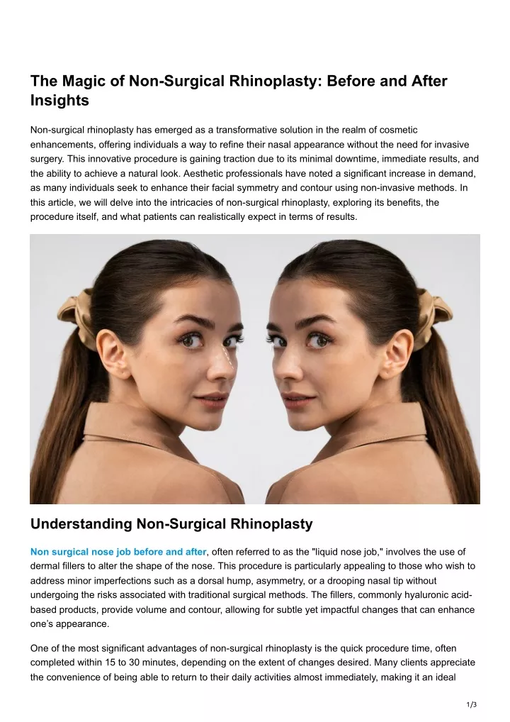 the magic of non surgical rhinoplasty before