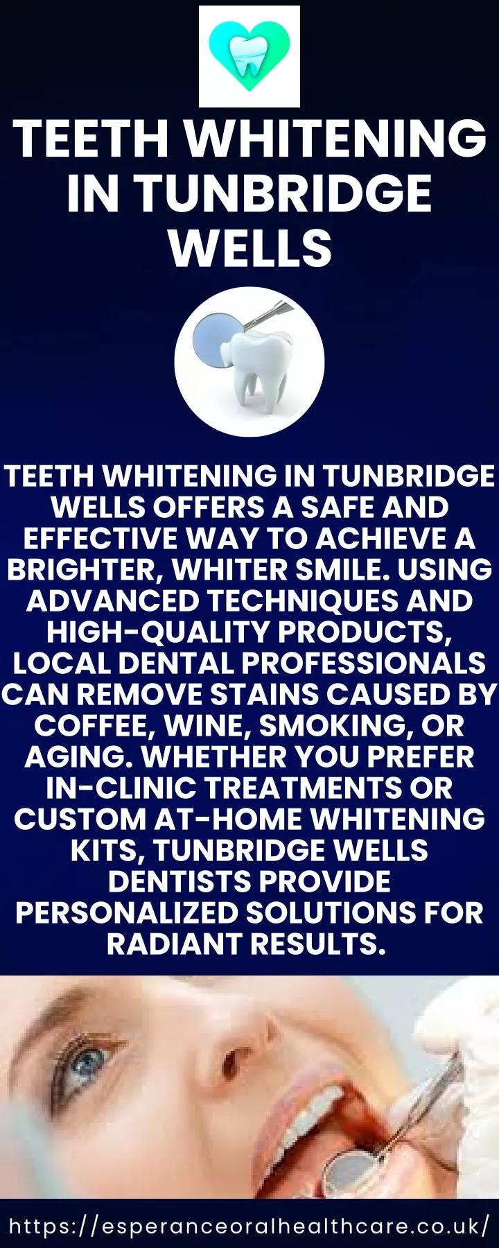 teeth whitening in tunbridge wells