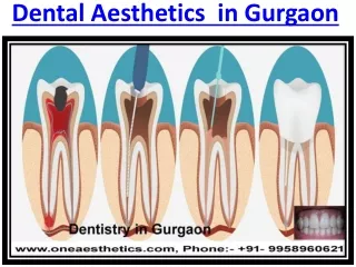 Painless Dentistry Of Root Canal Treatment in Gurgaon