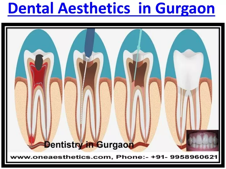 dental aesthetics in gurgaon