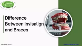 Difference Between Invisalign and Braces- Thyme Dental