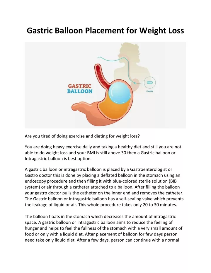 gastric balloon placement for weight loss