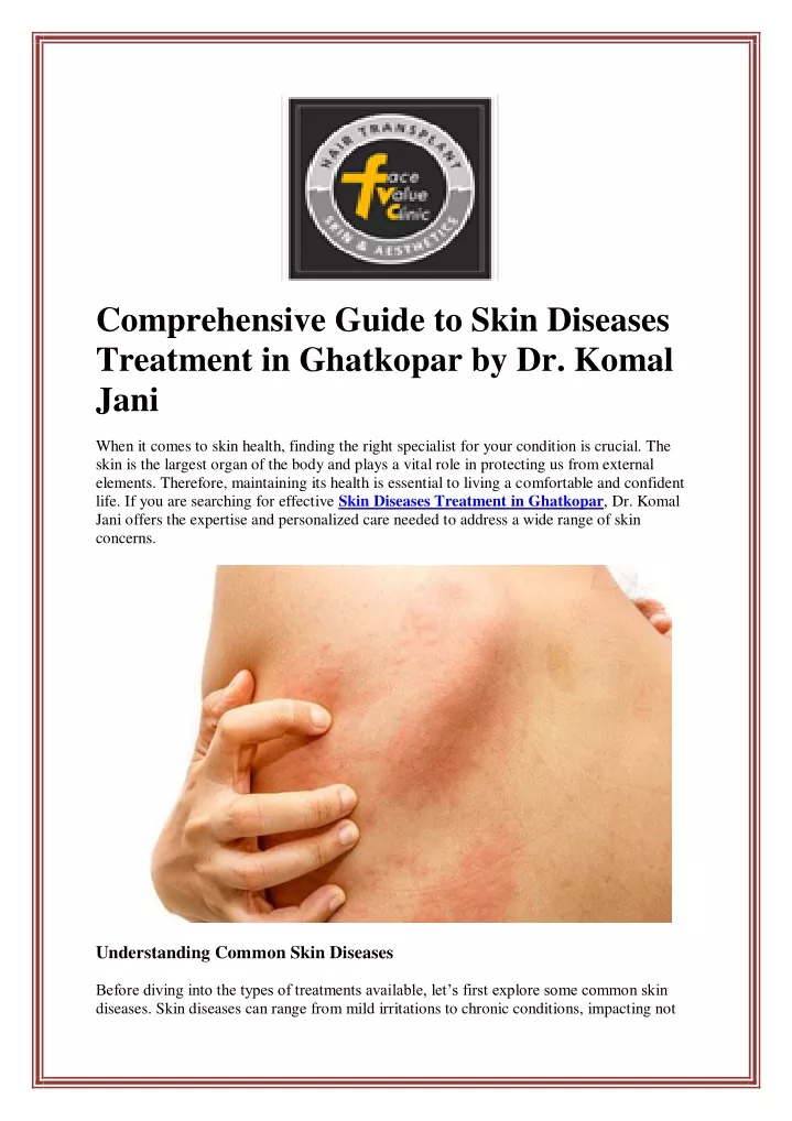 comprehensive guide to skin diseases treatment